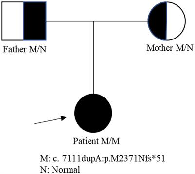 Case report: Hereditary spastic paraplegia with a novel homozygous mutation in ZFYVE26